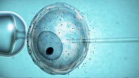 Fekondimi in vitro (IVF)